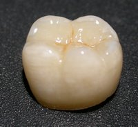 зубная-коронка-Сумы