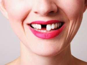 Основные причины выпадения зубов