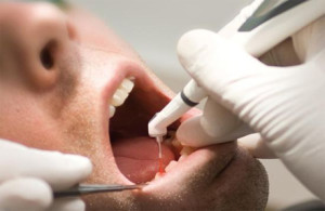 Лазерная стоматология в Сумах