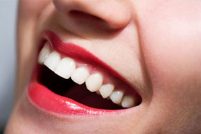Рекомендации после отбеливания зубов