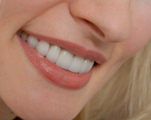 Восстановление зубов в Сумах