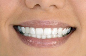 Зубы из металлокерамики Сумы
