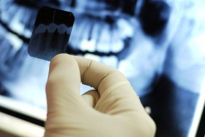 Рентген зубов в Сумах