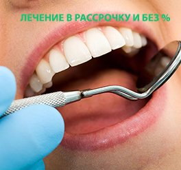 Лечение зубов в рассрочку и без %