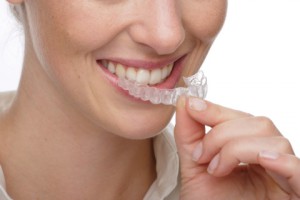 Отбеливающие каппы для зубов