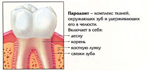 Симптомы, диагностика парадонтита