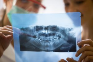 Рентген зубов и беременность. Результаты исследования