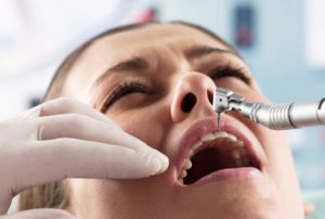 Как перебороть свой страх при визите к стоматологу?