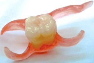 Классификация и современные системы микропротезов